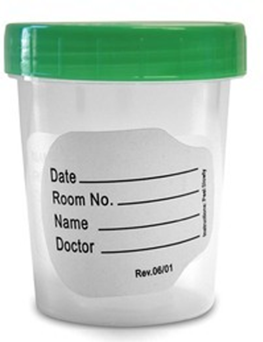 Plasticware-urine-container