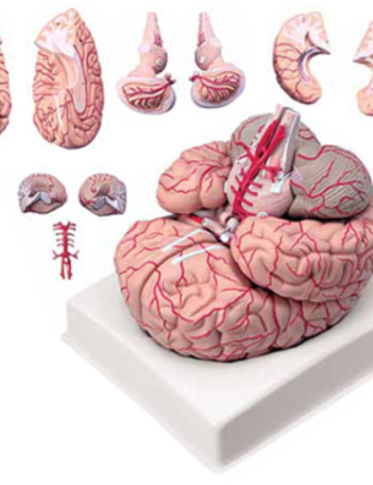 Brain-With-Arteries-9-Parts