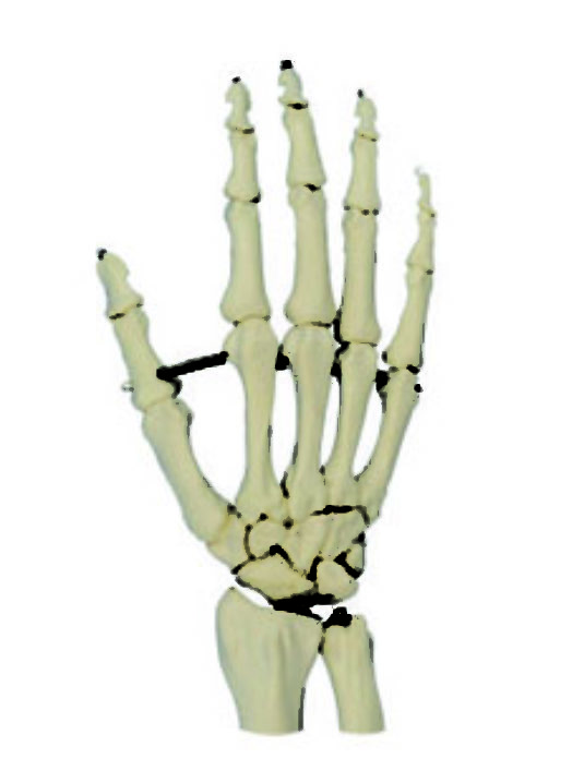 Hand-Bones