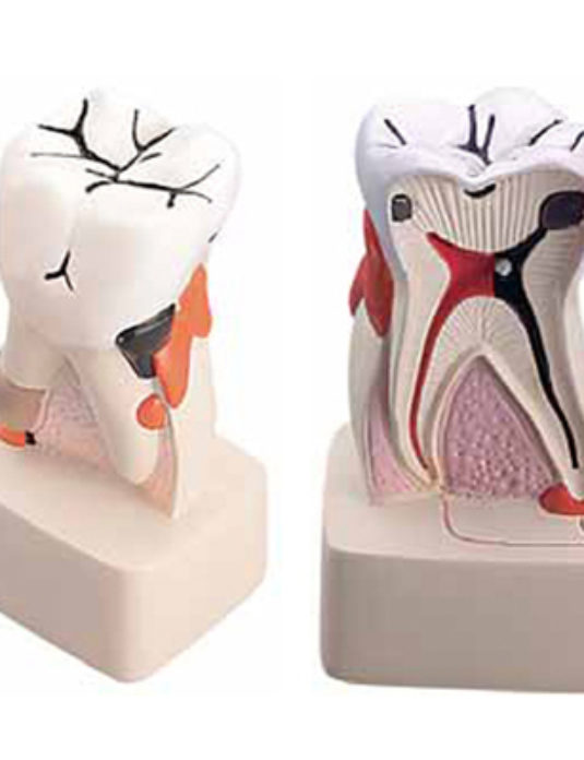 Dental-Pathology-Model