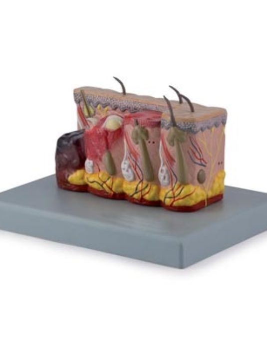 Pathological-Model-Of-Burned-Skin