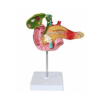 Pathological-Model-Of-The-Pancreas
